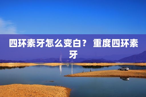 四环素牙怎么变白？ 重度四环素牙