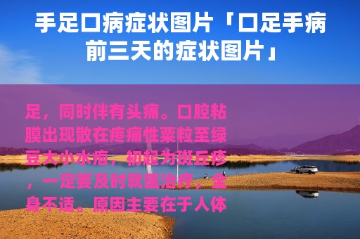 手足口病症状图片「口足手病前三天的症状图片」