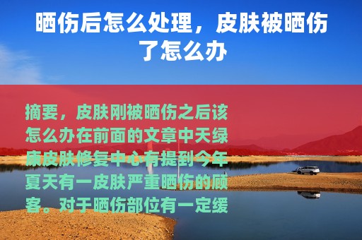 晒伤后怎么处理，皮肤被晒伤了怎么办