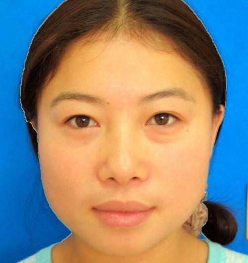 怎么用ps美白皮肤？（ps怎样美白皮肤）