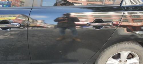 被车撞伤对方全责一般能赔多少？（人被车撞了对方全责怎么赔偿）