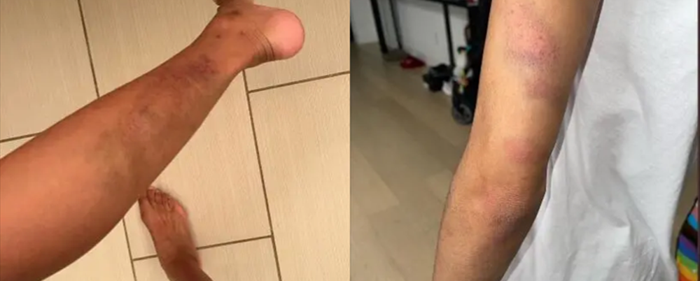 兹维列夫家暴（维金斯妻子控诉布里奇斯家暴）