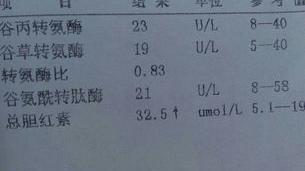 胆红素高调理下能降下去？ 胆红素高