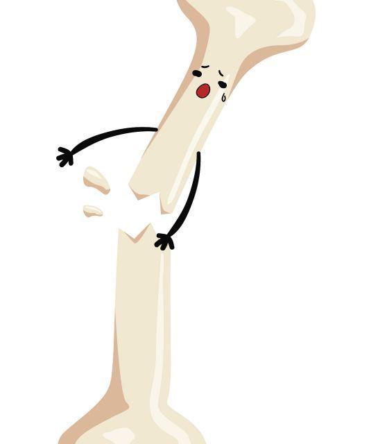 农民工骨折私了应该怎么谈判？ 骨折私了赔偿10大忌