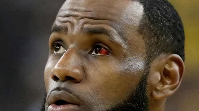 詹姆斯资产10亿美元金币（詹姆斯资产10亿美元）