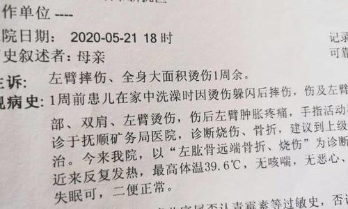 轻微伤鉴定标准及量刑 伤情鉴定标准及量刑